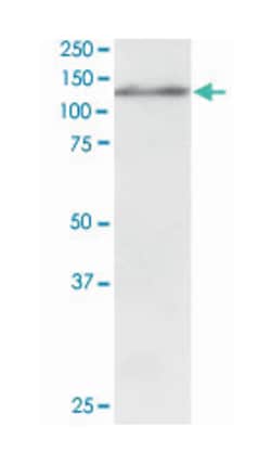 USP11, Goat, Polyclonal Antibody, Abnova 100 &mu;g | Buy Online | Abnova Corporation | Fisher Scientific