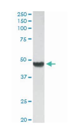 ACTA2, Goat, Polyclonal Antibody, Abnova 100&mu;g; Unlabeled:Antibodies,