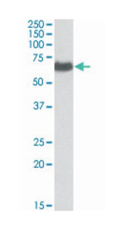 EHD2, Goat, Polyclonal Antibody, Abnova 100 &mu;g | Buy Online | Abnova | Fisher Scientific