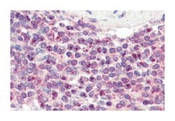 NR1H2, Goat, Polyclonal Antibody, Abnova 100 &mu;g | Buy Online | Abnova Corporation | Fisher Scientific