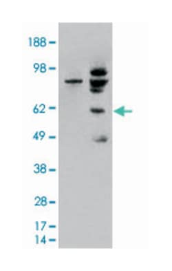 MDM2, Goat, Polyclonal Antibody, Abnova 100 &mu;g | Buy Online | Abnova Corporation | Fisher Scientific