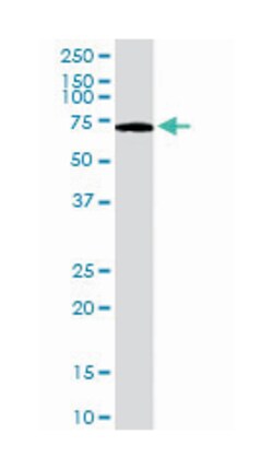 PARP2, Goat, Polyclonal Antibody, Abnova 100 &mu;g | Buy Online | Abnova Corporation | Fisher Scientific