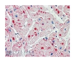 pnpla2, Goat, Polyclonal Antibody, Abnova 100 &mu;g | Buy Online | Abnova | Fisher Scientific
