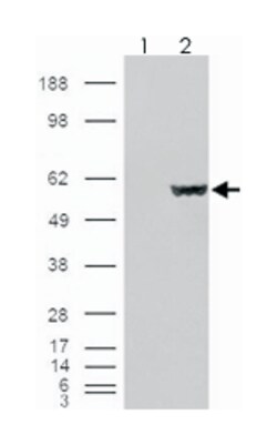 FH, Goat, Polyclonal Antibody, Abnova 100 &mu;g | Buy Online | Abnova Corporation | Fisher Scientific
