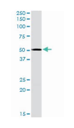 DDX19A/DDX19B, Goat, Polyclonal Antibody, Abnova 100&mu;g; Unlabeled:Antibodies,