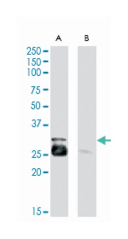 MYF5, Goat, Polyclonal Antibody, Abnova 100&mu;g; Unlabeled:Antibodies,
