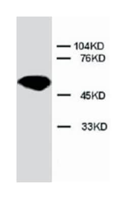 API5, Rabbit, Polyclonal Antibody, Abnova 100&mu;g; Unlabeled:Antibodies,