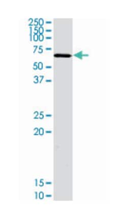 AKT2 (phospho S474), Rabbit anti-Human, Mouse, Rat, Polyclonal Antibody,