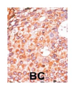 E2F1 (phospho S337), Rabbit anti-Human, Polyclonal Antibody, Abnova 400&mu;L;