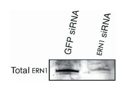 ERN1 Rabbit anti-Human, Mouse, Rat, Polyclonal Antibody, Abnova 100&mu;L;