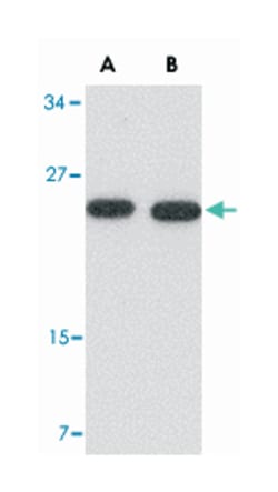 POFUT1, Rabbit, Polyclonal Antibody, Abnova 100&mu;g; Unlabeled:Antibodies,