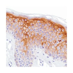 LYPD3, Rabbit, Clone: SP204, Abnova 100 &mu;L | Buy Online | Abnova Corporation | Fisher Scientific