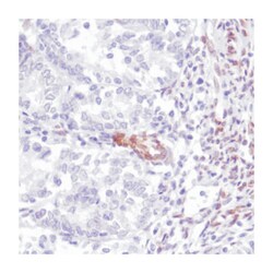 FBXW7, Rabbit, Clone: SP237, Abnova 100 &mu;L | Buy Online | Abnova Corporation | Fisher Scientific