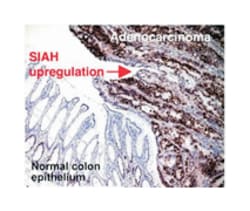 SIAH2, Mouse, Clone: 24E6H3, Abnova 500&mu;L; Unlabeled:Anticuerpos