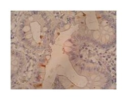 Sialyl Lewis a, Mouse, Clone: 121SLE, Abnova 100&mu;g; Unlabeled:Antibodies,