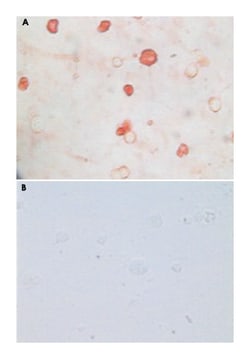 Kaposi's sarcoma-associated herpesvirus K8a, Mouse, Clone: 8C12G10G1, Abnova