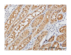 FAH, Mouse, Clone: 665a3, Abnova 100&mu;L; Unlabeled:Antibodies, Monoclonal