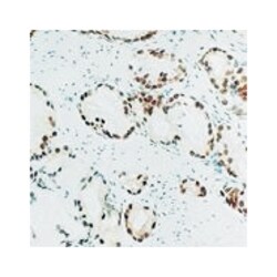 AR, Mouse, Clone: 2F12, Abnova 3 x 1mL; Unlabeled:Antibodies, Monoclonal