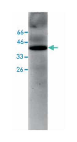 FAH, Mouse, Clone: 2, Abnova 100&mu;g; Unlabeled:Antibodies, Monoclonal