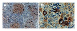 TRAF1 Rabbit anti-Human, Polyclonal Antibody, Abnova 50 &mu;L | Buy Online | Abnova | Fisher Scientific