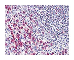 BCLAF1 Rabbit anti-Chimpanzee, Dog, Human, Mouse, Polyclonal Antibody,
