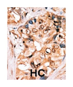 MAP2K1 (phospho S218/S222), Rabbit anti-Human, Polyclonal Antibody, Abnova 400 &mu;L | Buy Online | Abnova Corporation | Fisher Scientific