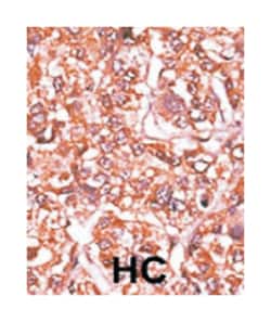 RB1 (phospho S612), Rabbit anti-Human, Polyclonal Antibody, Abnova 400&mu;L;