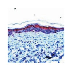 IVL Rabbit anti-Human, Polyclonal Antibody, Abnova 100&mu;L; Unlabeled:Antibodies,