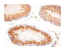 FGF8, Rabbit, Polyclonal Antibody, Abnova 100&mu;g; Unlabeled:Antibodies,