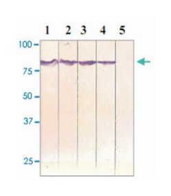 CTNNB1 (phospho S33/37), Rabbit anti-Human, Mouse, Rat, Polyclonal Antibody,