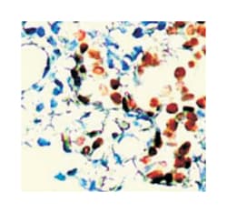 AR Rabbit anti-Human, Mouse, Rat, Polyclonal Antibody, Abnova 100 &mu;g | Buy Online | Abnova | Fisher Scientific