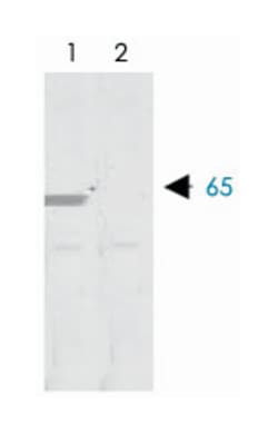 MMP8 Rabbit anti-Human, Polyclonal Antibody, Abnova 100&mu;g; Unlabeled:Antibodies,
