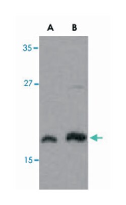 MLST8 (GBL) Rabbit anti-Human, Mouse, Rat, Polyclonal Antibody, Abnova