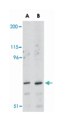 ASAH2 Rabbit anti-Human, Mouse, Rat, Polyclonal Antibody, Abnova 100&mu;g;