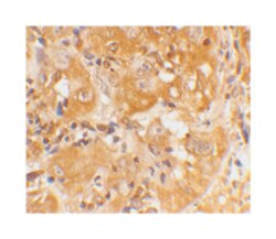 BCL2L11 Rabbit anti-Human, Mouse, Rat, Polyclonal Antibody, Abnova 100 &mu;g | Buy Online | Abnova | Fisher Scientific