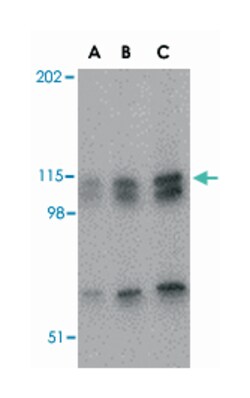 NPAS3 Rabbit anti-Human, Mouse, Rat, Polyclonal Antibody, Abnova 100 &mu;g | Buy Online | Abnova Corporation | Fisher Scientific