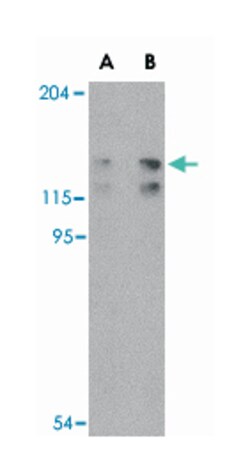 FYB Rabbit anti-Human, Mouse, Polyclonal Antibody, Abnova 100 &mu;g | Buy Online | Abnova | Fisher Scientific