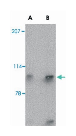 SLITRK4 Rabbit anti-Human, Mouse, Rat, Polyclonal Antibody, Abnova 100&mu;g;