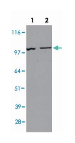 NBN Rabbit anti-Human, Mouse, Polyclonal Antibody, Abnova 100&mu;L; Unlabeled:Antibodies,