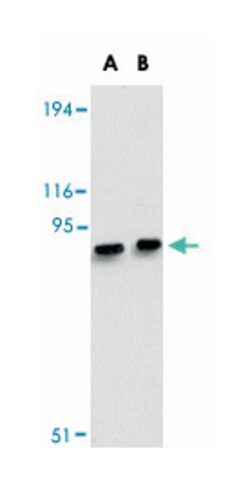 MACC1, Rabbit, Polyclonal Antibody, Abnova 100&mu;g; Unlabeled:Antibodies,