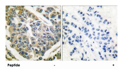 COL4A1 Rabbit anti-Human, Mouse, Polyclonal Antibody, Abnova 100&mu;g;