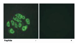 EMCN Rabbit anti-Human, Mouse, Rat, Polyclonal Antibody, Abnova 100&mu;g;