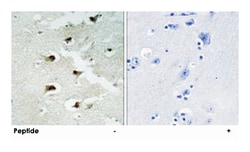 CDCA4, Rabbit, Polyclonal Antibody, Abnova 100&mu;g; Unlabeled:Antibodies,