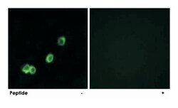 ACOT1, Rabbit, Polyclonal Antibody, Abnova 100&mu;g; Unlabeled:Antibodies,