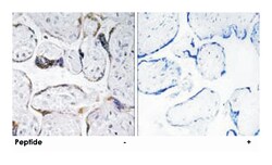 ELOVL3, Rabbit, Polyclonal Antibody, Abnova 100&mu;g; Unlabeled:Antibodies,