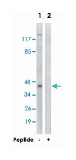 KCNJ9, Rabbit, Polyclonal Antibody, Abnova 100&mu;g; Unlabeled:Antibodies,
