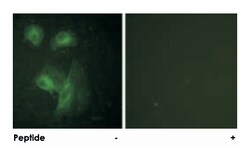 RPS6KB1 Rabbit anti-Human, Mouse, Rat, Polyclonal Antibody, Abnova 100&mu;g;
