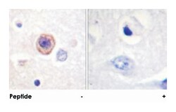 TPH1 Rabbit anti-Human, Mouse, Rat, Polyclonal Antibody, Abnova 100 &mu;g | Buy Online | Abnova Corporation | Fisher Scientific