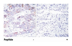 ELK1 Rabbit anti-Human, Mouse, Rat, Polyclonal Antibody, Abnova 100&mu;g;