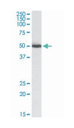 ALDH2, Goat, Polyclonal Antibody, Abnova 100&mu;g; Unlabeled:Antibodies,